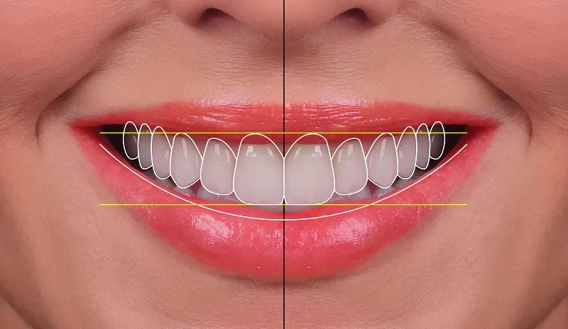 Analyzing a pretty white smile