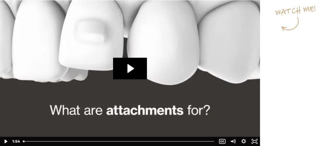 A close-up illustration of a dental attachment on a tooth with the text What are attachments for?